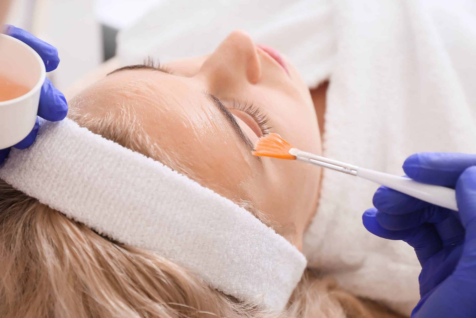 Reveal Radiant Skin with VI Peels: A Deep Dive into the Benefits of Chemical Peels