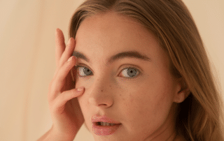 VI Peel treatment for melasma at Columbine Aesthetics, reducing dark spots for a clearer complexion. Call (720) 504-4407 to learn more.