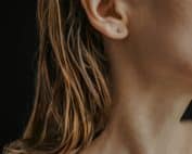 Botox treatment to manage excessive sweating at Columbine Aesthetics. Call (720) 504-4407 for a consultation.