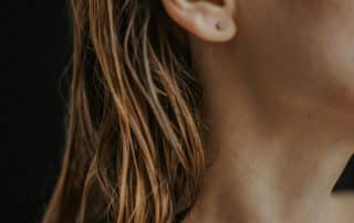 Botox treatment to manage excessive sweating at Columbine Aesthetics. Call (720) 504-4407 for a consultation.