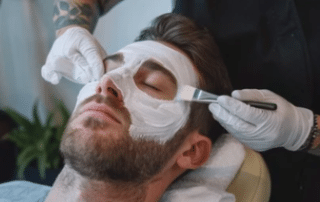 Chemical peel treatment for men at Columbine Aesthetics, designed to smooth skin, reduce breakouts, and promote healthy skin renewal. Call (720) 504-4407 today!