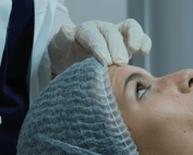 Columbine Aesthetics Dysport for crow’s feet treatment, smoothing fine lines for a youthful appearance. Call (720) 504-4407 to book a consultation.