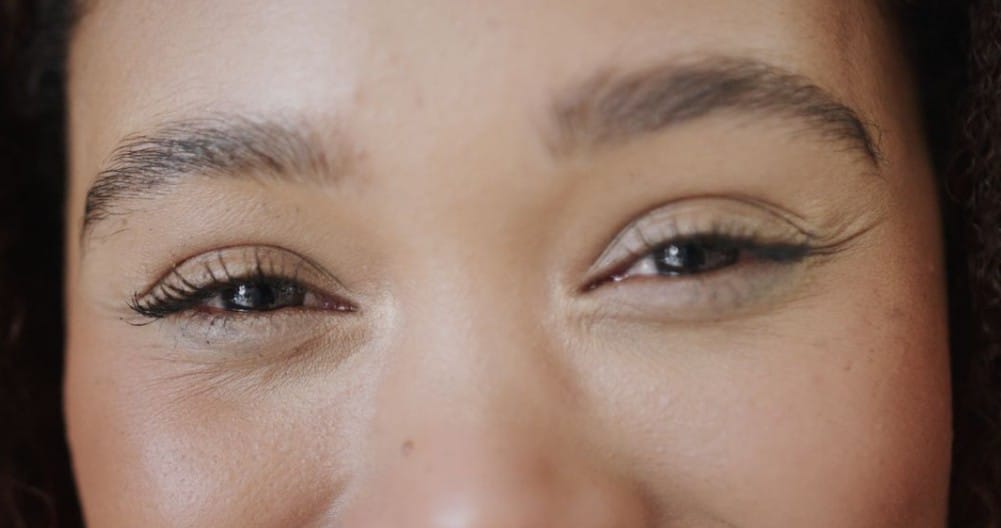 Microneedling