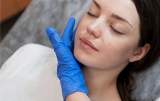 Client with sensitive skin receiving a gentle microneedling treatment at Columbine Aesthetics — call 720-504-4407 to restore smoother, healthier skin safely and comfortably.